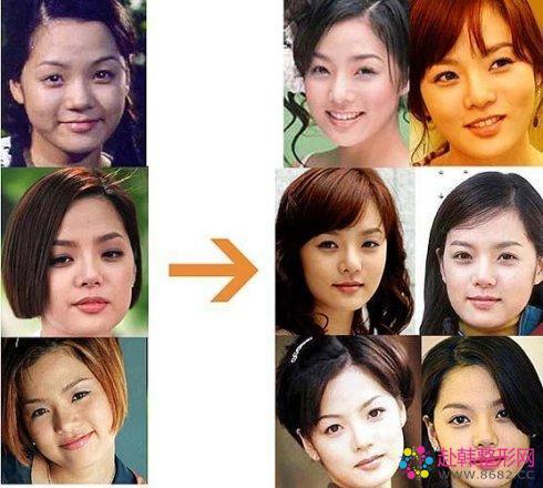 金星爆料整容女星图片视频,揭秘整容女星的真实面貌,图片视频曝光惊人真相 第3张 金星爆料整容女星图片视频,揭秘整容女星的真实面貌,图片视频曝光惊人真相 第3张